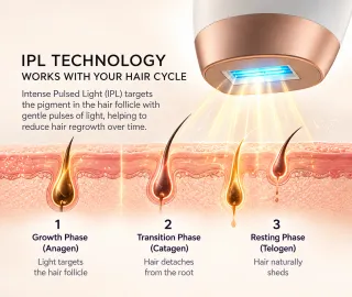 IPL and hair-growth-cycle illustration